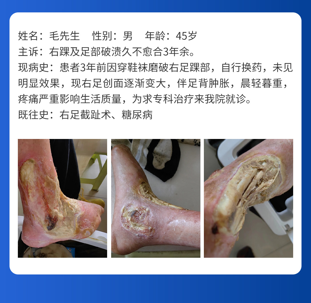 【北京市中西医结合华体会体育(中国)HTH·官方网站】首期会诊圆满成功！(图8)