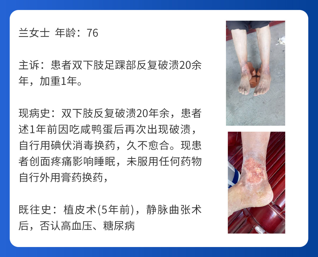 【北京市中西医结合华体会体育(中国)HTH·官方网站】第二期会诊圆满成功！(图6)