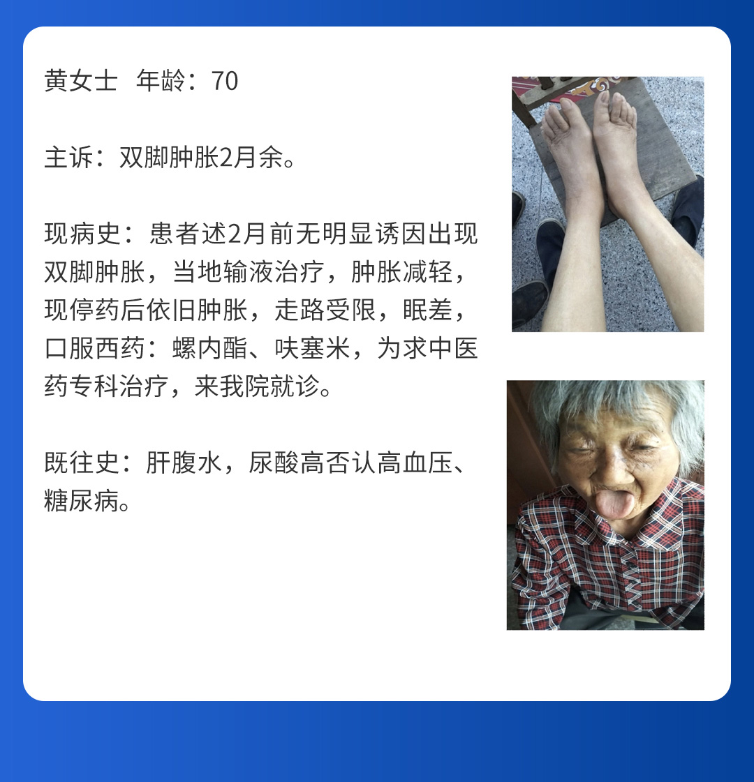 【北京市中西医结合华体会体育(中国)HTH·官方网站】第三期会诊(图7)
